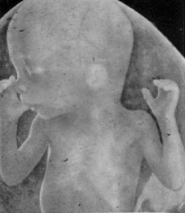 Bebé chupa su dedo dentro del útero